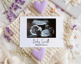 Purple Baby in Bloom Pregnancy Announcement | Editable Floral Baby Reveal Template, Digital Instant Download for Social Media & Printing