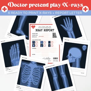 Könnte beinhalten: Ein Set von Spiel-Röntgenbildern zum Ausdrucken für Kinder. Die Bilder zeigen Röntgenaufnahmen von Fuß, Hand, Schädel und anderen Körperteilen. Der Text auf den Drucken lautet "Doctor pretend play X-rays" und "XRAY REPORT".