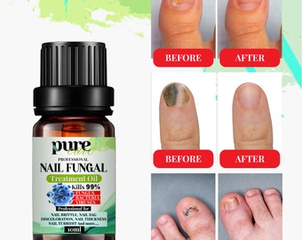 Anti Fungal Treatment Fungus Effective Toe Nail Repair Solution UK - 10ML