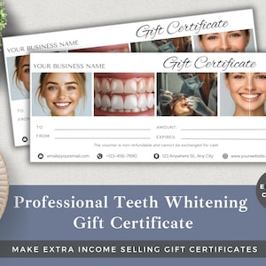 Buono regalo sbiancante per denti personalizzabile / Modello Canva modificabile / Download immediato / Buono aziendale premium / Regalo sorriso luminoso