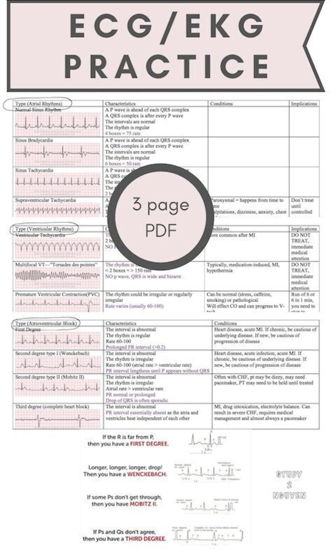 Normal and Abnormal ECG/EKG Practice With Physical Therapy Implications