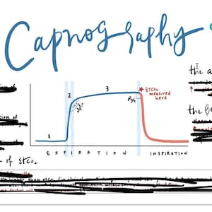 May include: A blue and red line graph illustrating the concept of capnography, which measures the amount of carbon dioxide in exhaled breath. The graph shows the different phases of exhalation and inhalation, with the alpha and beta phases labeled. The text "ETCO2 measured here" is highlighted in red.