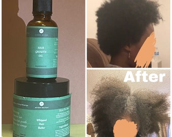 Buy Hair Growth Oil and Whipped Hair Butter Set Online in India - Etsy Buy Hair Growth Oil and Whipped Hair Butter Set Online in India - Etsy