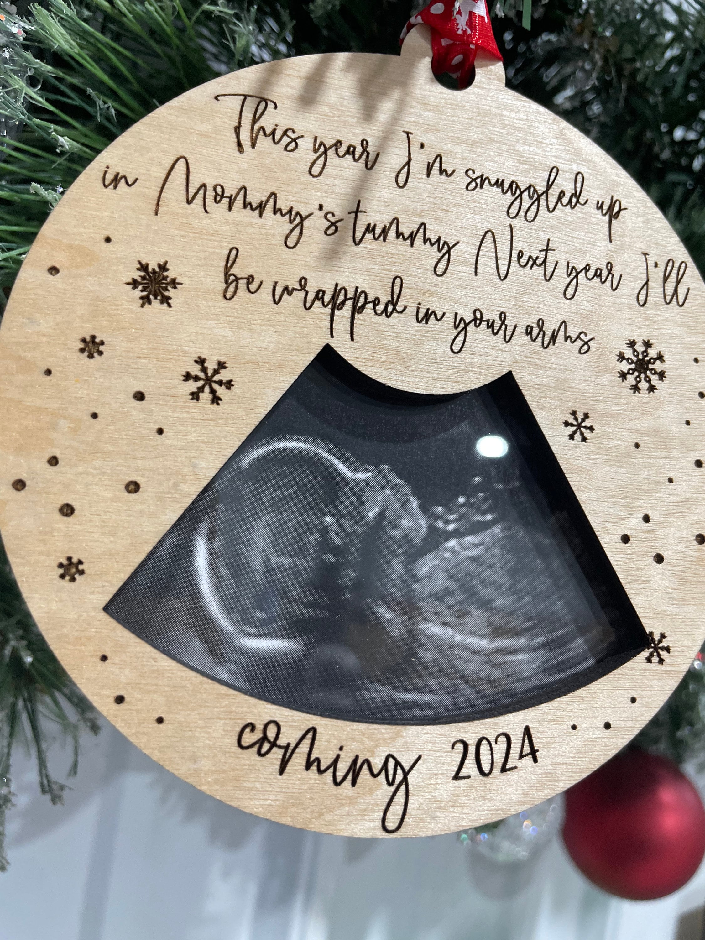 Sonogram Ornaments Personalized Ultrasound Photo Christmas