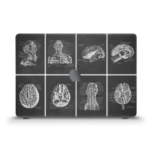 Peut inclure: Une illustration anatomique en noir et blanc du cerveau et du cou humains sur un fond noir. L'illustration est divisée en neuf sections, chacune montrant une vue différente du cerveau ou du cou.