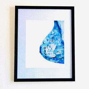 Print: Mammogram
