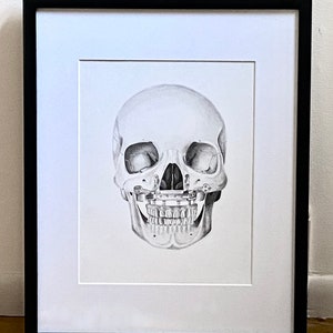 Maxillary Free Flap Print