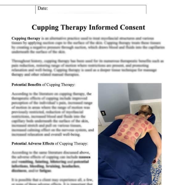 Cupping Therapy Informed Consent Form, Massage Therapy Cupping, Suction Cups, Alternative Medicine, Myofascial Release,
