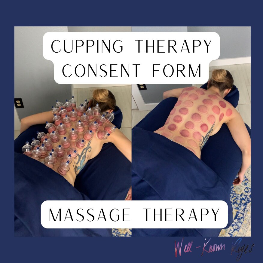Triangle Cupping Form Cupping Therapy Informed Consent Form, Massage Therapy Cupping, Suction ...
