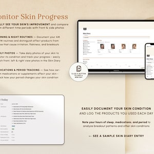 May include: A screenshot of a computer screen and a mobile phone showing a skin diary app. The app allows users to track their skin care routine, medications, and period. The app also includes a feature to take daily photos of the skin to monitor progress.