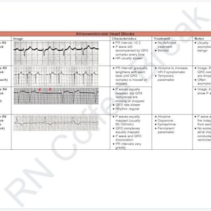 EKG Nursing NCLEX Study Notes