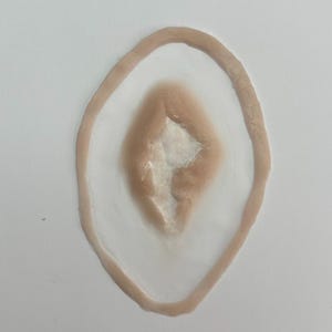 Small prosthetic eye surgery