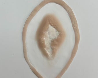 Kleine Augenprothesenoperation