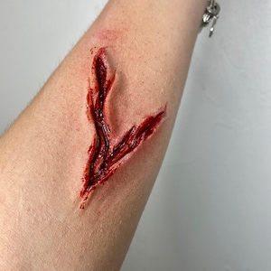Prosthesis Injury 0020