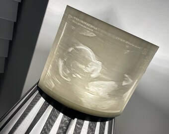 Baby scan 3D print - lithophane stand