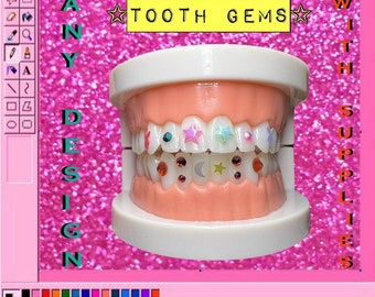 Tooth gems