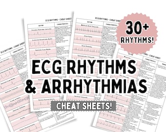 ECG Rhythms & Dysrhythmias Cheat Sheets