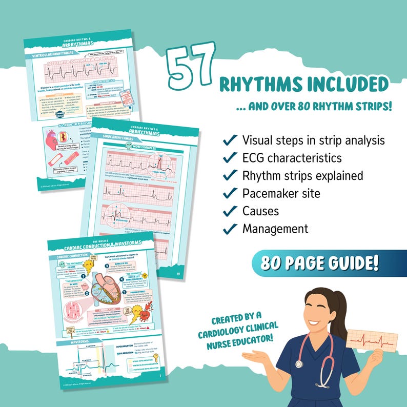 Cardiac Rhythms: A Visual Guide | EKG Interpretation - Spiral Bound ...
