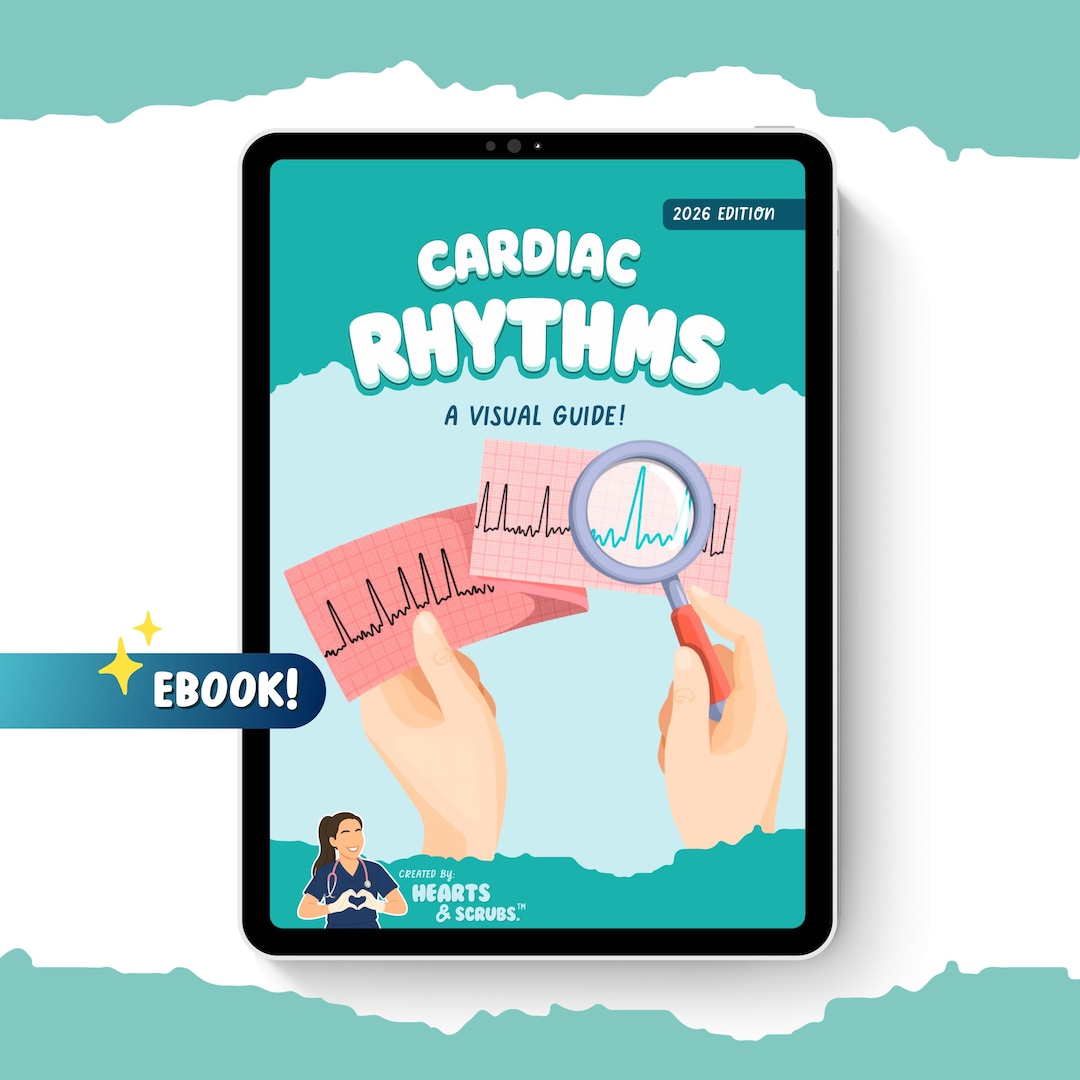 EKG Cardiac Rhythms Ebook | 75+ Page Visual Guide | Digital Download - Etsy