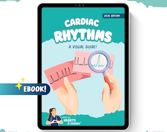 EKG Cardiac Rhythms eBook | 75+ Page Visual Guide | Digital Download