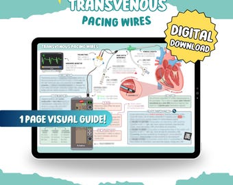 Transvenous Temporary Pacing Guide: 1-Page Visual Summary (Digital Download)