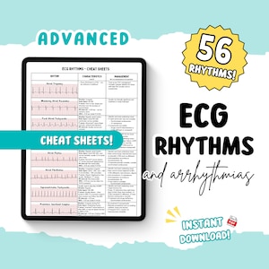 Aide-mémoire sur les rythmes et les arythmies ECG avancés | Plus de 55 rythmes | Guide d'étude de l'infirmière (téléchargement numérique)