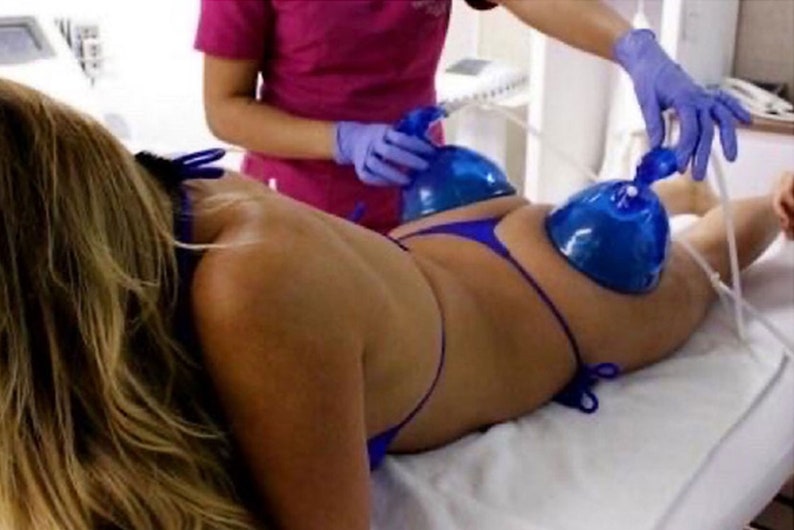 May include: A person lying on a white table with two blue suction cups attached to their body. The suction cups are connected to tubes. A person wearing a pink shirt and blue gloves is holding one of the tubes.