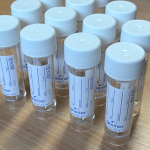 Contenedores universales de 30 ml para muestras de orina, frasco de muestra etiquetado, vendedor del Reino Unido