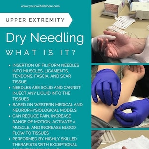 Puede incluir: La punción seca es una técnica que consiste en insertar agujas finas en los músculos, ligamentos, tendones, fascia y tejido cicatricial. Se basa en modelos médicos occidentales y neurofisiológicos y puede reducir el dolor, aumentar el rango de movimiento, activar un músculo y aumentar el flujo sanguíneo a los tejidos. La punción seca es realizada por terapeutas altamente cualificados con habilidades excepcionales de palpación y conocimiento de la anatomía.