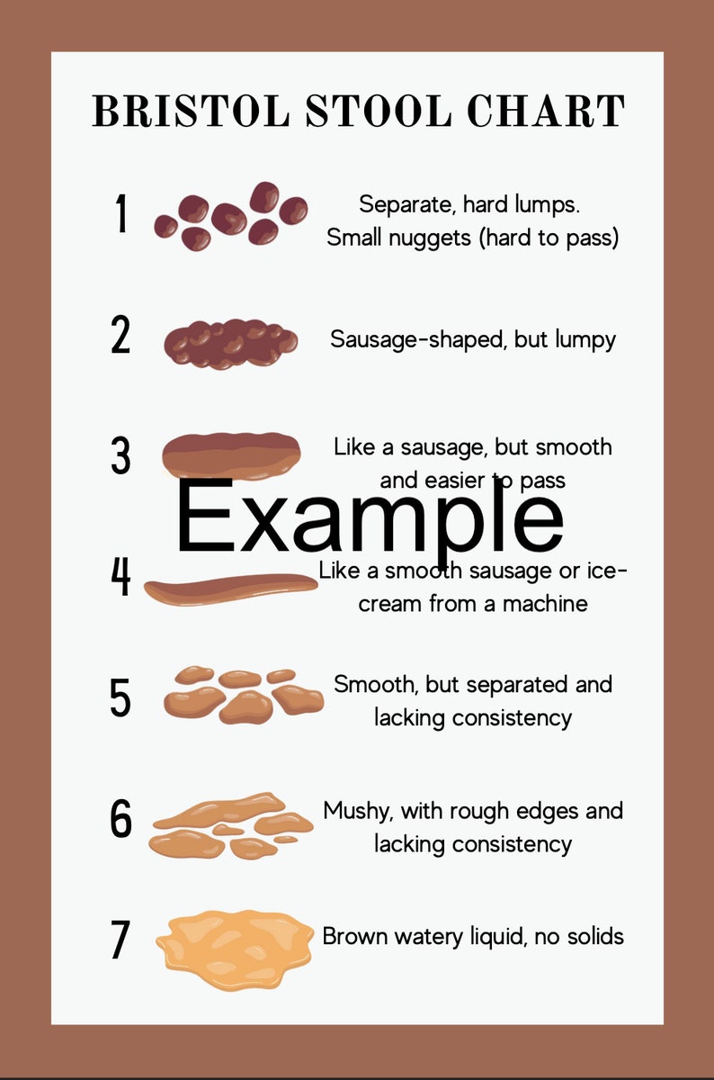 Bristol Stool Chart - Clinic Resource - Etsy