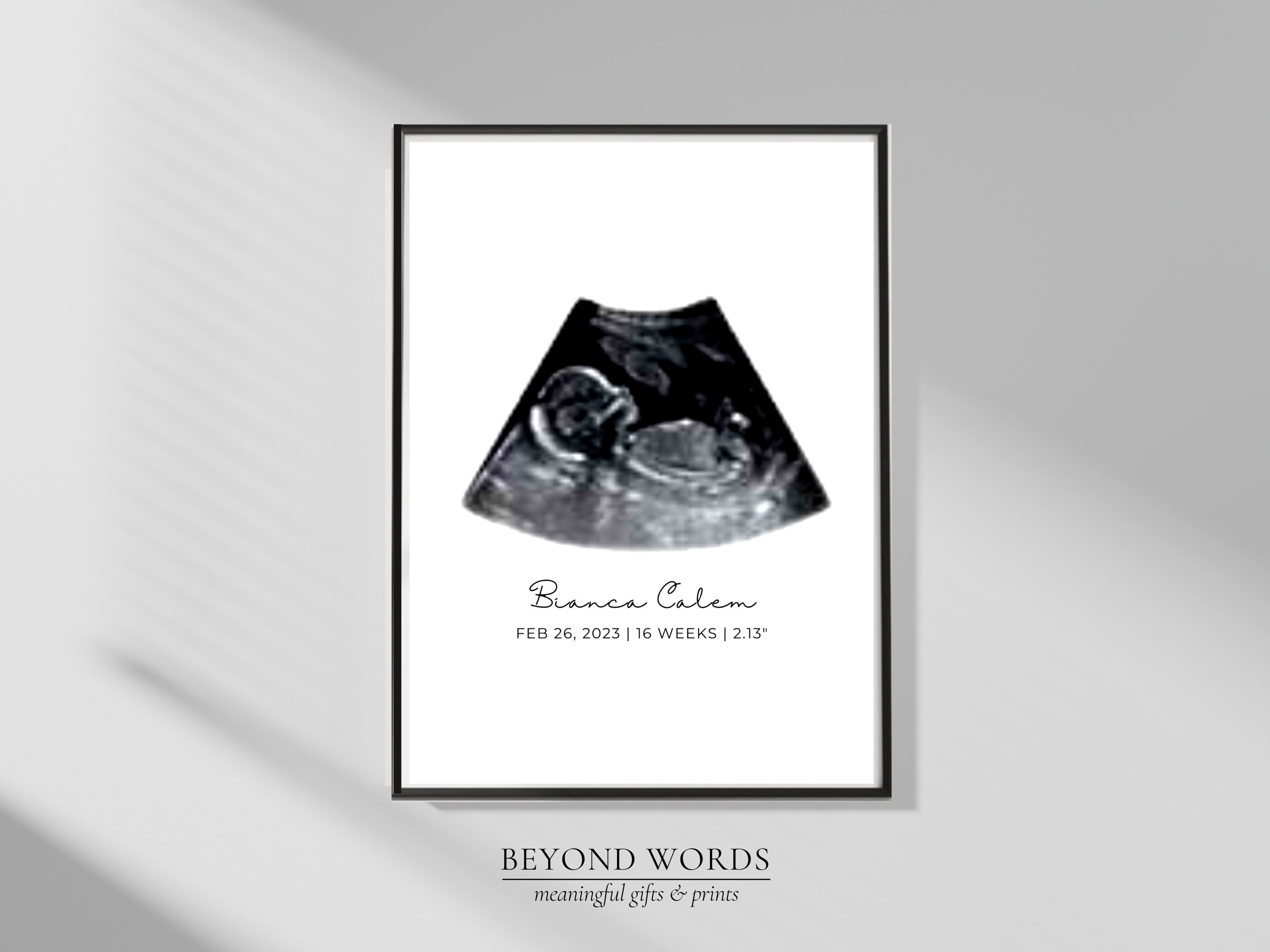Ultrasound Artwork Custom Birth Keepsake Personalized Ultrasound Baby