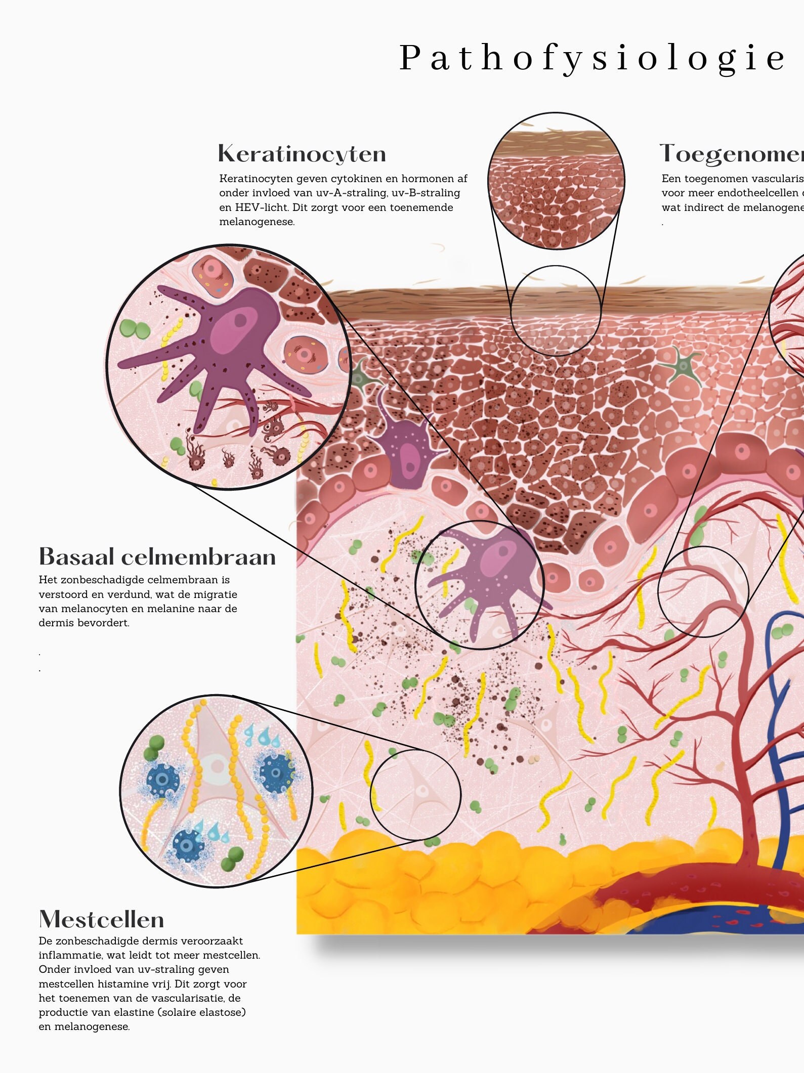 Melasma Pathofysiolgy Skin Anatomy Huid Anatomie - Etsy