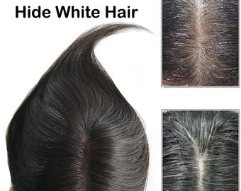 2.7x4" Human Hair Toppers For Women Thin Clips In Swiss Lace Topper Natural Scalp Top to Hide Bald or White Hair 10"