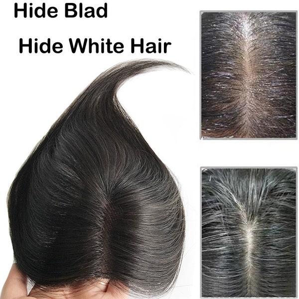 2.7x4" Human Hair Toppers For Women Thin Clips In Swiss Lace Topper Natural Scalp Top to Hide Bald or White Hair 10"