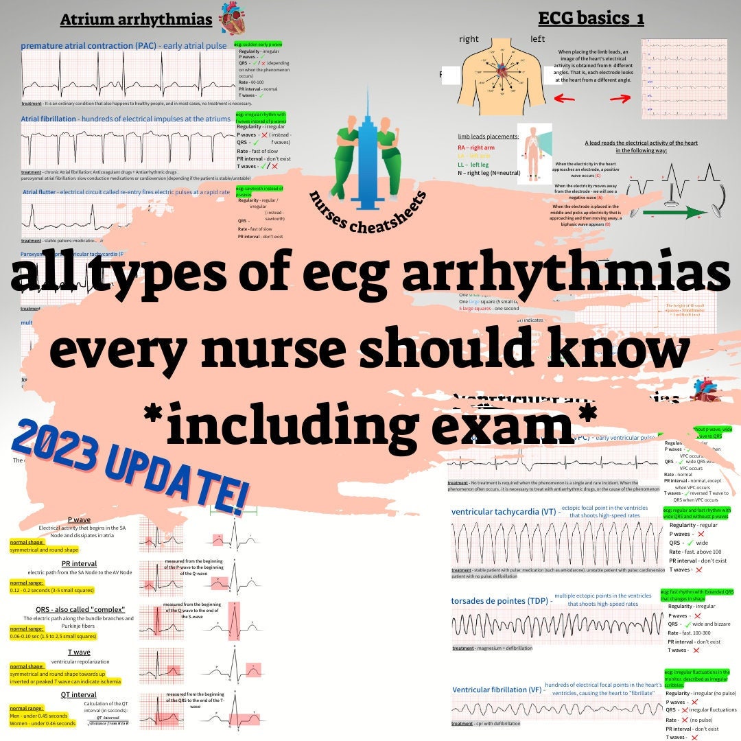 ECG Basics All Types Of Ecg Arrhythmias Every Nurse And Nursing Student
