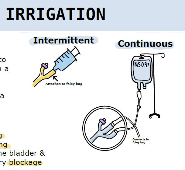 Irrigation Pumps for sale Only 4 left at 75