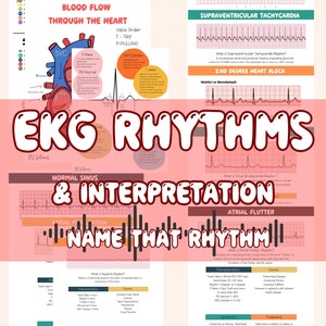 EKG Cheat Sheet: Rhythm Interpretation & Dysrhythmias (Digital Download)