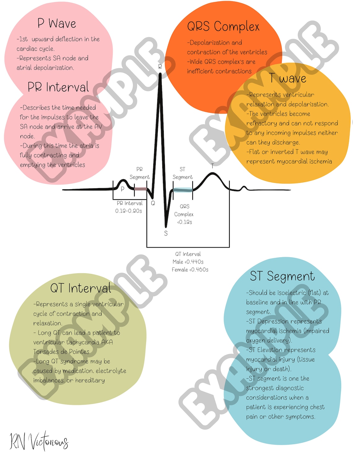 EKG Cheat Sheet EKG Study Guide EKG Practice Etsy