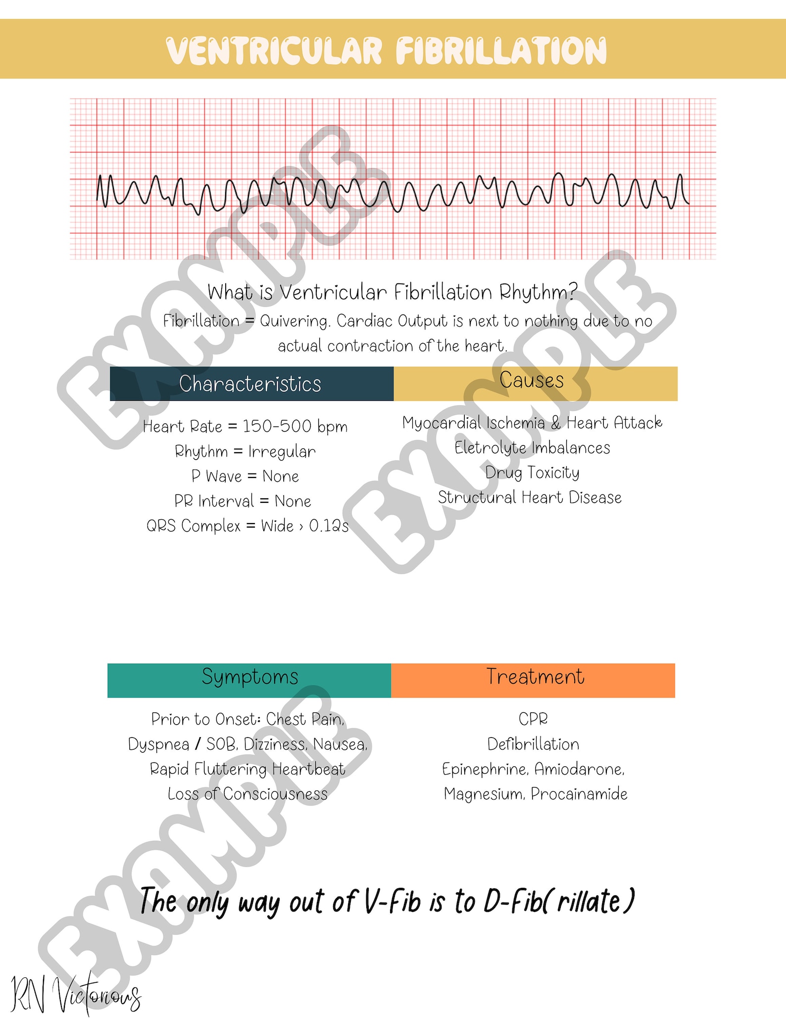 EKG Cheat Sheet EKG Study Guide EKG Practice Etsy