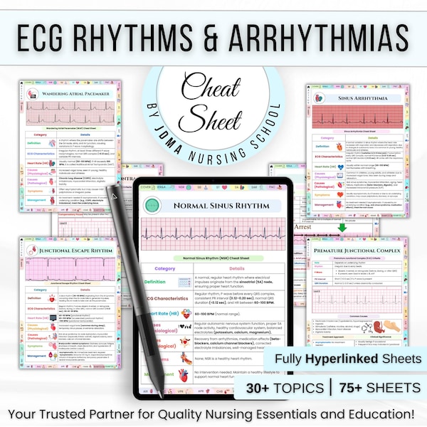 75+ ECG Rhythm & Arrhythmias Cheat Sheet, ECG Study Guide, Nursing Notes, Medical Cheat Sheet, Nursing Student, Free Stickers or Cover pages
