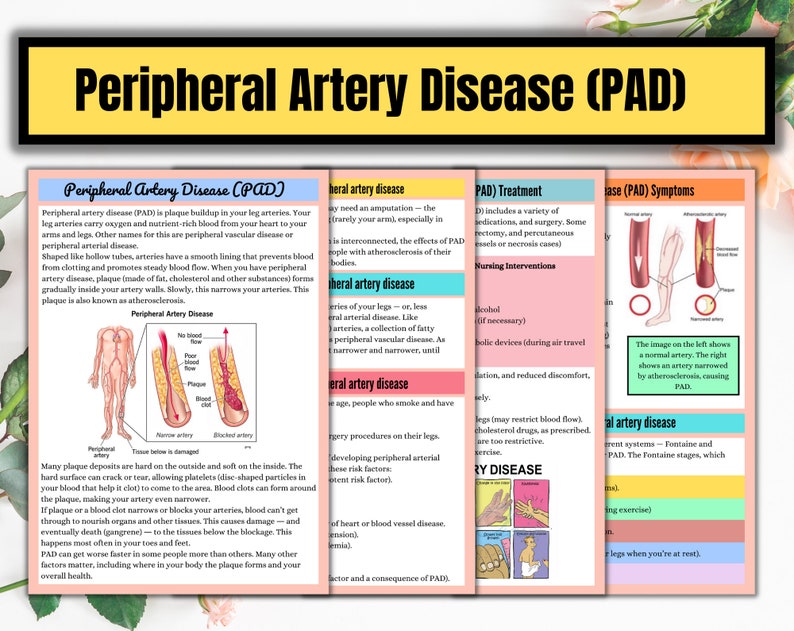 May include: An infographic explaining peripheral artery disease (PAD), a condition where plaque builds up in the arteries of the legs, restricting blood flow. The infographic includes illustrations of healthy and diseased arteries, as well as information on symptoms, treatment, and nursing interventions.