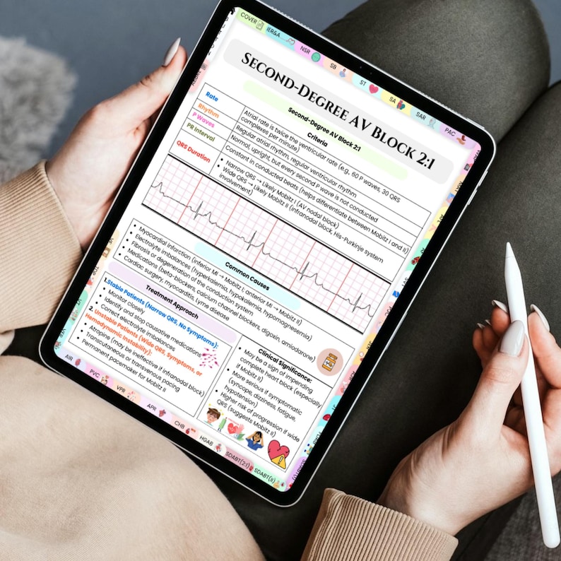 May include: A digital tablet displaying medical information about Second-Degree AV Block 2:1. The screen shows text, a heart rhythm graph, and lists of criteria, common causes, and treatment approaches. A stylus is held near the screen.
