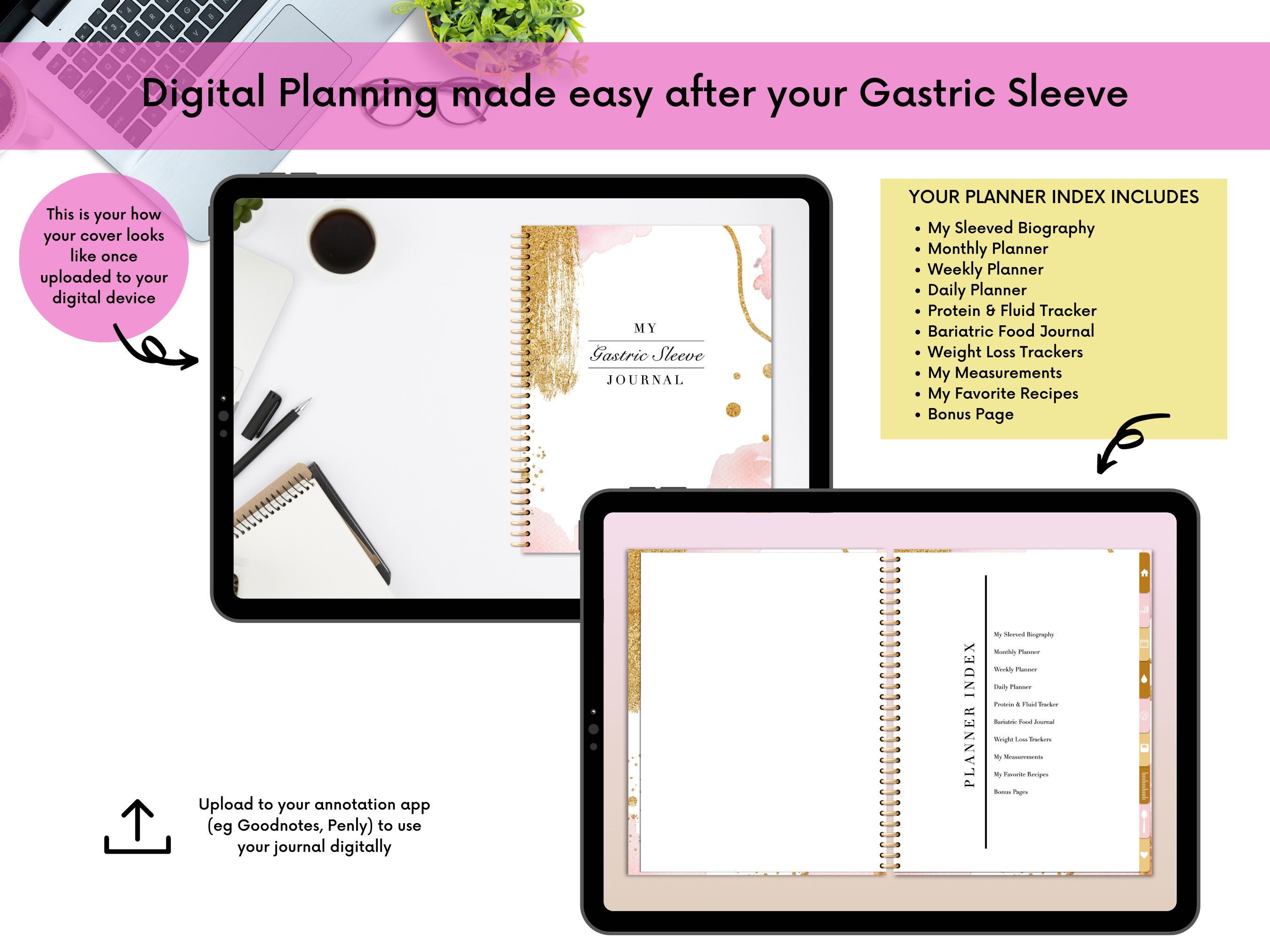 Digital Gastric Sleeve Journal VSG Hyperlinked Digital Etsy