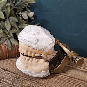 May include: A dental articulator made of brass holding a plaster dental model of upper and lower teeth. The device features a metallic frame with a screw adjustment mechanism, supporting the white and beige cast of the human dental arch.