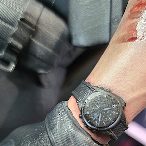 May include: Close-up of a black wristwatch with a textured face and a black fabric band. The watch is on a wrist with a visible wound. The watch face has multiple dials and hands.