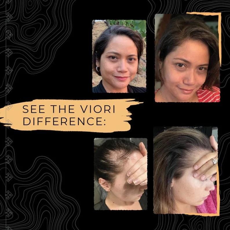 Viori Longsheng Rice Shampoo Bar Citrus Yao Etsy