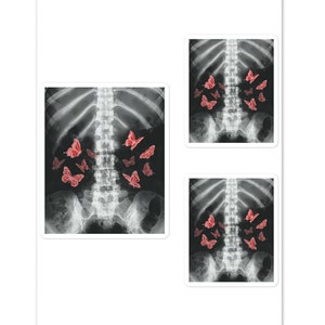 Y2K Egirl Xray Skeleton, Adesivo farfalla rossa, Harajuku Dark Grunge, Adesivo per laptop in vinile lucido