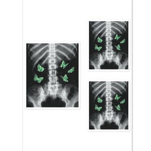 Edgy EGirl Xray Skeleton & Grüner Schmetterling Aufkleber, Harajuku Dark Grunge Geschenk für Jugendliche, Künstler, Emo Fans Geburtstage, Halloweens