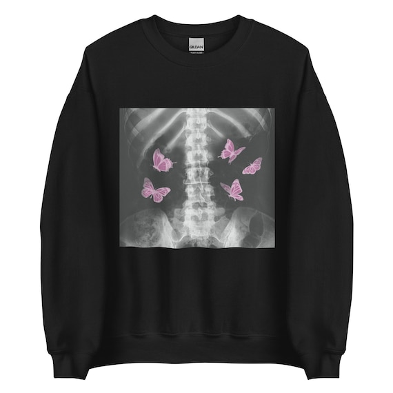 Egirl Xray Skeleton Pink Butterfly Unisex Sweatshirt, Harajuku y2k Dark Grunge, Gothic Aesthetic Art, Egirl Eboy Gift - Edgy Emo Radiology