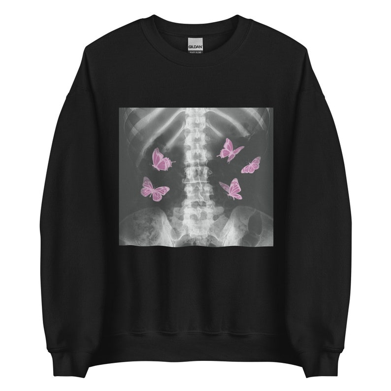 Egirl Xray Skeleton Pink Butterfly Unisex Sweatshirt, Harajuku y2k Dark Grunge, Gothic Aesthetic Art, Egirl Eboy Gift - Edgy Emo Radiology Black